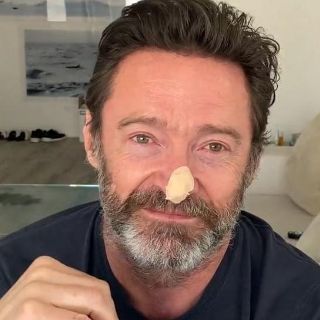 Hugh Jackman se somete a otra biopsia y alerta sobre el cáncer de piel