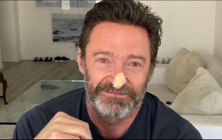 Hugh Jackman mostró su estado en redes sociales. @TheHughJackman / Instagram