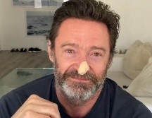 Hugh Jackman mostró su estado en redes sociales. @TheHughJackman / Instagram
