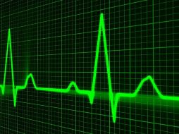 El síndrome del corazón roto se trata de una afección cardiáca. Pixabay