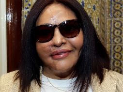 Carmen Sánchez, víctima de ataque con ácido. EFE