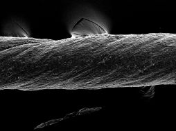 Mediante una capa de hidrogel, las suturas pueden contener micropartículas capaces de detectar inflamaciones, moléculas de fármacos o células vivas. EFE/Imagen cedida por el MIT