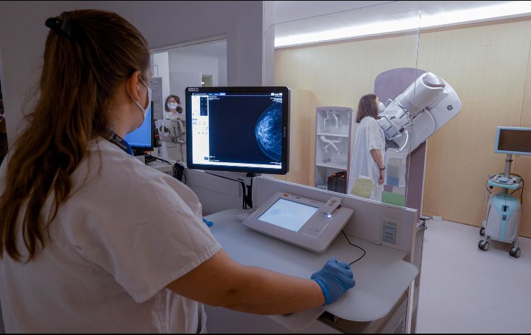 Los estudios mamográficos son clave en la detección de los cánceres mamarios. EFE/Archivo