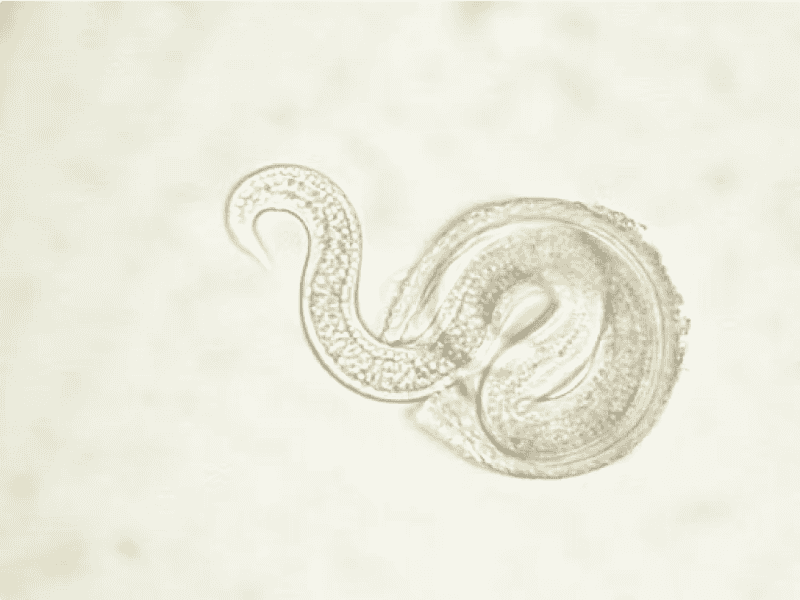  Larva de Toxocara. SuSanA Secretariat/Flickr, CC BY-NC  
