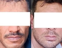 Los presuntos motoladrones fueron detenidos en la Colonia San Miguel de Mezquitán. ESPECIAL