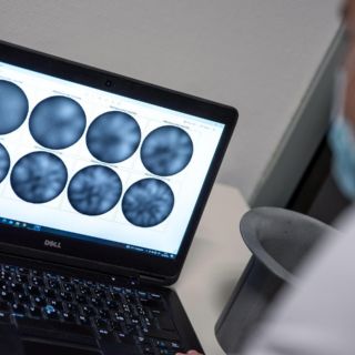 Crean una molécula capaz de detectar y tratar el cáncer con precisión