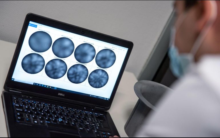 Podría ayudar a convertir el cáncer en una enfermedad crónica y potenciar la eficacia de los fármacos para combatirlo, aseguran los científicos. EFE/Archivo.