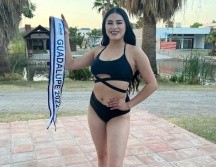 Dulce Mijares fue operada de emergencia. ESPECIAL