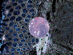 Un perfil dual -histológico y molecular- para determinar el estadio y gravedad de un cáncer u otras enfermedades, auguran los desarrolladores sobre Orion. EFE/ Imagen cedida por Laboratorios Santagata y Sorger