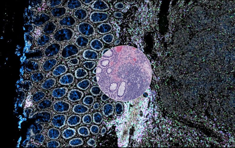 Un perfil dual -histológico y molecular- para determinar el estadio y gravedad de un cáncer u otras enfermedades, auguran los desarrolladores sobre Orion. EFE/ Imagen cedida por Laboratorios Santagata y Sorger