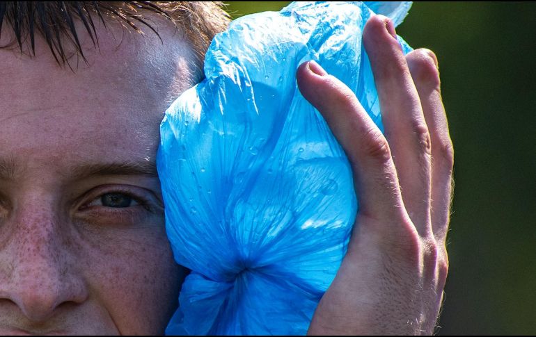 Cuando recibes un golpe en cualquier parte del cuerpo puede ser muy molesto tenerlo inflamado. ESPECIAL / Foto de Leonid Antsiferov en Unsplash