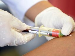 El estigma social en torno al VIH impide que las personas conozcan su diagnóstico, pues por miedo, no se someten a las pruebas para su detección. EFE / ARCHIVO