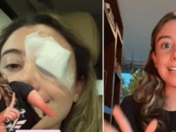 Probó aceite de coco orgánico para quitar el maquillaje de los ojos. SUN