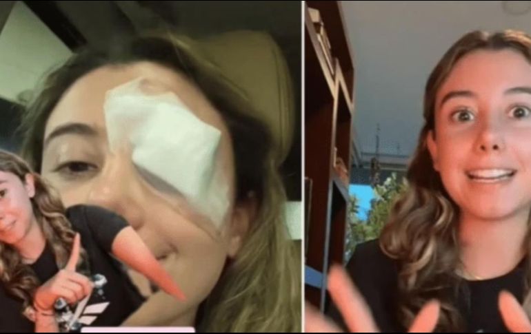 Probó aceite de coco orgánico para quitar el maquillaje de los ojos. SUN