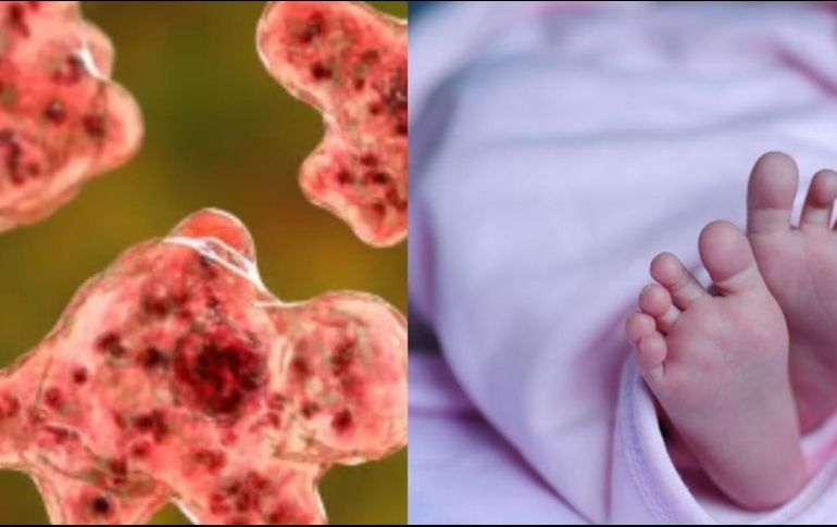 La Naegleria fowleri tiene una tasa de mortalidad de 97%. SUN