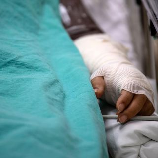 La Ssa vigila 12 municipios por casos de lepra, 3 de estos en Jalisco