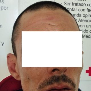 Con operativo americana detienen a hombre tras marturbarse frente a una menor de edad