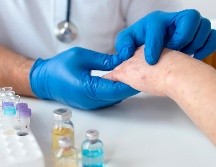 De momento no existe medicamento que elimine la afección, pero si hay algunos tratamientos de primera línea. ESPECIAL/Freepik