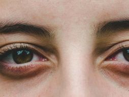 Hay diversos factores por los cuales aparecen las ojeras. ESPECIAL/Unsplash