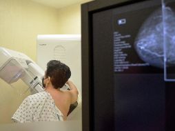 Para promover la prevención y detección oportuna del cáncer de mama, el Hospitalito llevará a cabo el Mes Rosa, en el que cada paciente tendrá un protocolo personalizado. ESPECIAL.