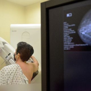 Promueven la prevención y detección del cáncer de mama en el Hospitalito