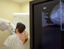 Para promover la prevención y detección oportuna del cáncer de mama, el Hospitalito llevará a cabo el Mes Rosa, en el que cada paciente tendrá un protocolo personalizado. ESPECIAL.