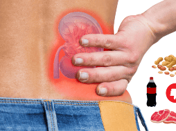 Limitar la ingesta de estos alimentos puede ayudar a mantener la salud renal. ESPECIAL / Prexels vía blueshot