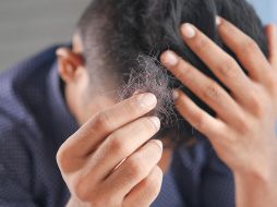 Si se te está empezando a caer el cabello checa cuál es la mejor vitamina para evitar este proceso. Unsplash.