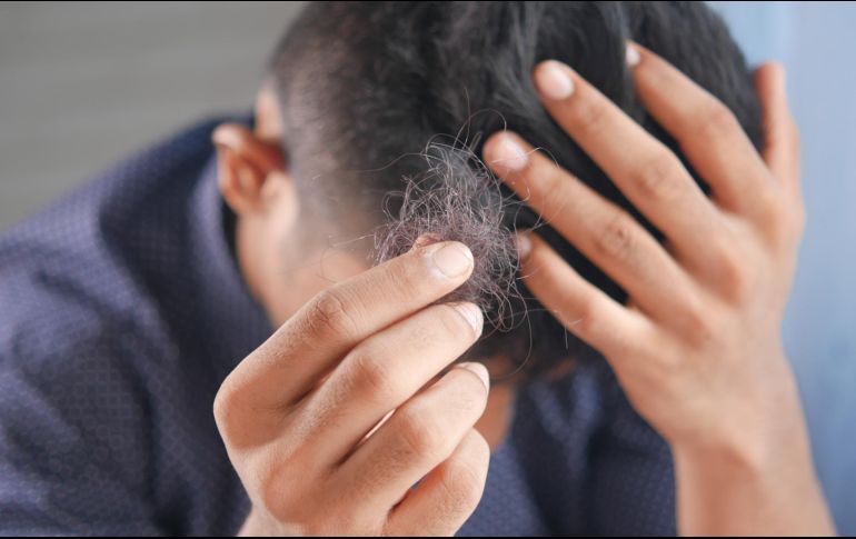 Si se te está empezando a caer el cabello checa cuál es la mejor vitamina para evitar este proceso. Unsplash.