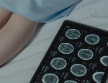 Hospitales Puerta de Hierro y la organización REVIVE Centro impulsan una campaña para concientizar y atender los infartos cerebrales. Unsplash.