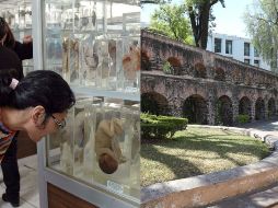 El Museo de Patología del Hospital General Eduardo Liceaga exhibe en sus vitrales al menos mil piezas diferentes de órganos. ESPECIAL / GOB. DE MÉXICO /INAH