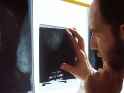 Es importante mencionar que los síntomas del cáncer de páncreas, cuando se presentan, son similares a los de muchas otras enfermedades. Foto de National Cancer Institute en Unsplash