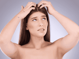 Los granos en la cabeza pueden generar pérdida de cabello. ESPECIAL