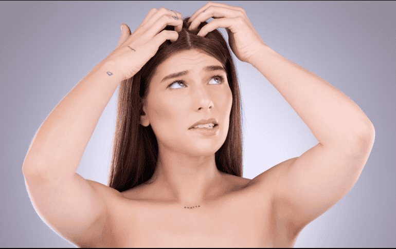 Los granos en la cabeza pueden generar pérdida de cabello. ESPECIAL