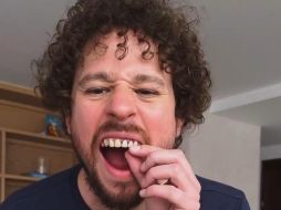 Esto pasó con los dientes de Luisito Comunica. CAPTURA