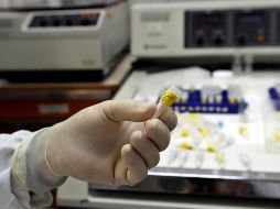 La FDA informó de la aprobación de Casgevy y Lyfgenia para contrarrestar los efectos de este trastorno genético. EFE / ARCHIVO