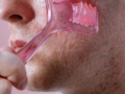 El cloracné es una enfermedad cutánea crónica de tipo acné que se produce por la sobre exposición a ciertos hidrocarburos aromáticos halogenados. Pexels.