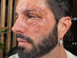 El famoso publicó esta foto en sus redes. IG: @ponchodenigris