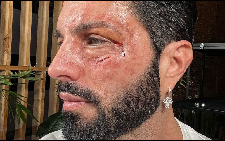 El famoso publicó esta foto en sus redes. IG: @ponchodenigris