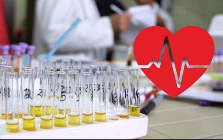 Estas son las señales de esta afectación que es provocada por diversas causas. EL INFORMADOR / ARCHIVO