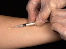 El sarampión fue declarado eliminado en el año 2000, pero ha vuelto a resurgir. Pixabay