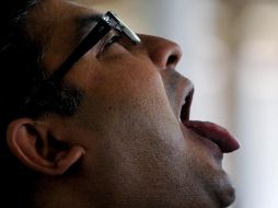 Sin embargo, es un padecimiento muy sencillo de prevenir, pues no se requiere de ningún tratamiento caro, sino de llevar a cabo las recomendaciones usuales de una o un experto en odontología. AFP / ARCHIVO