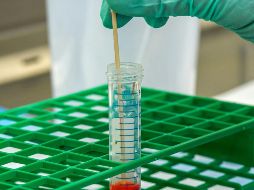 La elección de un estilo de vida saludable es clave. ESPECIAL / CDC