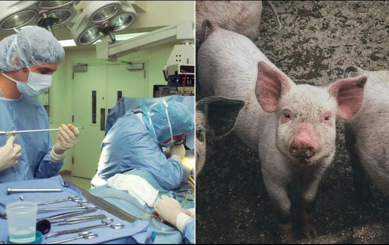 Los científicos desactivaron retrovirus endógenos del cerdo para minimizar posibles infecciones. UNSPLASH / D.  Renco /  National Cancer Institute / ARCHIVO