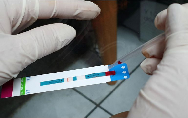 Por lo menos el 30% de la población mundial ha sido detectada con VIH. EL INFORMADOR/ARCHIVO