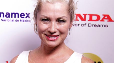 La actriz es madre de Luciano, un niño con esta condición. SUN/ARCHIVO