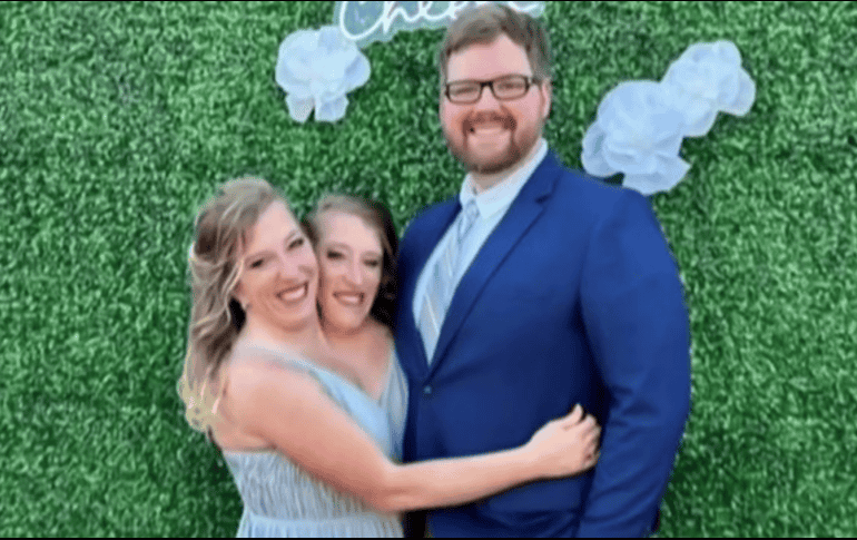 Abby y Brittany han demostrado que con determinación, se puede superar cualquier obstáculo.X/@rcavada