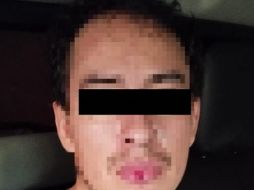 La víctima, de unos 30 años de edad, presentaba evidentes heridas causadas por disparos de arma de fuego. ESPECIAL