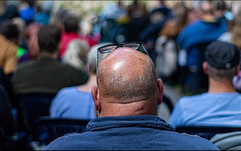 La calvicie, remarca, alude a la caída del cabello excesiva por lo que las acciones de las personas al respecto suelen ser variadas. Pixabay