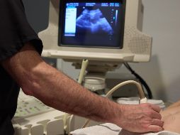 Reviven en Estados Unidos una ley antiaborto de 1864